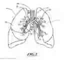 Fig. 03 - Systems, devices, and methods for treating a pulmonary disorder with an agent