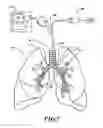 Fig. 08 - Systems, devices, and methods for treating a pulmonary disorder with an agent