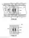 Fig. 15 - Systems, devices, and methods for treating a pulmonary disorder with an agent