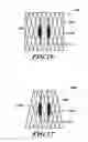 Fig. 16 - Systems, devices, and methods for treating a pulmonary disorder with an agent