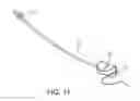 Fig. 12 - Device implantable in tissue of a prostate gland or a bladder