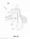 Fig. 02 - Compressible needleless valve assembly