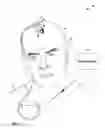 Fig. 02 - MECHANICAL FEEDTHROUGHS FOR IMPLANTABLE MEDICAL DEVICE