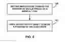 Fig. 07 - MECHANICAL FEEDTHROUGHS FOR IMPLANTABLE MEDICAL DEVICE