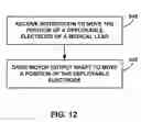 Fig. 15 - MECHANICAL FEEDTHROUGHS FOR IMPLANTABLE MEDICAL DEVICE