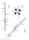 Fig. 02 - Electro catheter for neurostimulation