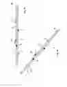 Fig. 03 - Electro catheter for neurostimulation