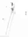 Fig. 15 - Devices and methods for treating craniofacial pain