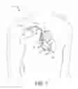 Fig. 04 - Automatic selection of parameters of an exposure mode of an implantable medical device