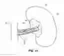 Fig. 35 - System and method for optogenetic therapy