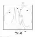 Fig. 44 - System and method for optogenetic therapy