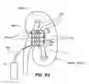 Fig. 74 - System and method for optogenetic therapy