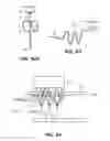 Fig. 87 - System and method for optogenetic therapy