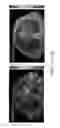 Fig. 09 - Systems and methods for radiation treatment planning using combined imaging and treatment dose