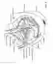 Fig. 08 - Neuromodulation and associated systems and methods for the management of pain