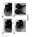 Fig. 03 - FOCUSED TRANSCRANIAL ULTRASOUND SYSTEMS AND METHODS FOR USING THEM