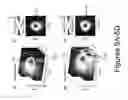 Fig. 06 - FOCUSED TRANSCRANIAL ULTRASOUND SYSTEMS AND METHODS FOR USING THEM