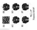Fig. 09 - FOCUSED TRANSCRANIAL ULTRASOUND SYSTEMS AND METHODS FOR USING THEM