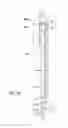 Fig. 10 - BAG FILTER EXTENDER