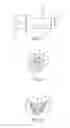 Fig. 04 - SELF SUPPORTING IN-CONTAINER MIX/BLEND SYSTEM