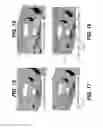 Fig. 09 - Lateral-flow assay device having flow constrictions