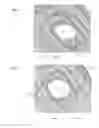 Fig. 06 - Lateral-flow assay device with filtration flow control