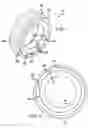 Fig. 02 - Tire Assembly