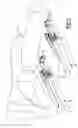 Fig. 02 - Seat-track assembly