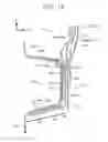 Fig. 15 - Automobile front pillar lower structure