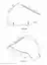 Fig. 23 - Wake-modifying device for a boat