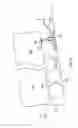 Fig. 09 - Trailer stabilizer and leveler
