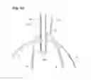 Fig. 35 - Tap, server, pouring member, and attachment/detachment tool