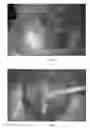 Fig. 03 - Utilizing Nitrate Salts in Order to Produce Explosives