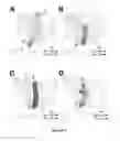 Fig. 10 - Antibacterial compounds targeting isoprenoid biosynthesis