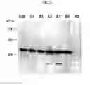 Fig. 04 - Multiple variants of meningococcal protein NMB1870