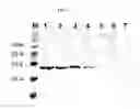 Fig. 08 - Multiple variants of meningococcal protein NMB1870