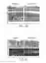 Fig. 18 - PTD-SMAD7 therapeutics