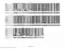 Fig. 03 - Methods for treating ulcers in thalassemia syndrome with an ActRIIB polypeptide