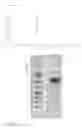 Fig. 04 - Methods for treating ulcers in thalassemia syndrome with an ActRIIB polypeptide