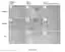 Fig. 45 - Methods for treating ulcers in thalassemia syndrome with an ActRIIB polypeptide