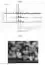 Fig. 02 - Up-conversion phosphor