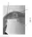 Fig. 11 - Perfusion bioreactor with tissue flow control and live imaging compatibility