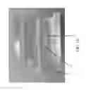 Fig. 12 - Perfusion bioreactor with tissue flow control and live imaging compatibility