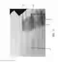 Fig. 14 - Perfusion bioreactor with tissue flow control and live imaging compatibility