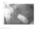 Fig. 02 - THREE-DIMENSIONAL BIOPRINTED PANCREATIC TUMOR MODEL
