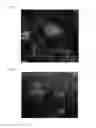 Fig. 05 - THREE-DIMENSIONAL BIOPRINTED PANCREATIC TUMOR MODEL