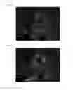 Fig. 06 - THREE-DIMENSIONAL BIOPRINTED PANCREATIC TUMOR MODEL