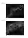 Fig. 10 - THREE-DIMENSIONAL BIOPRINTED PANCREATIC TUMOR MODEL