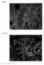 Fig. 11 - THREE-DIMENSIONAL BIOPRINTED PANCREATIC TUMOR MODEL
