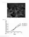 Fig. 14 - THREE-DIMENSIONAL BIOPRINTED PANCREATIC TUMOR MODEL
